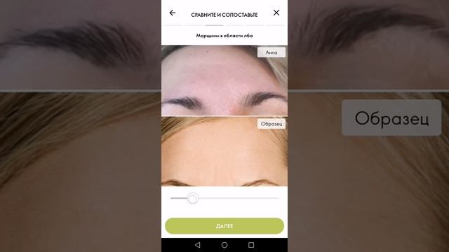 Приложение Скин Эксперт смотреть онлайн