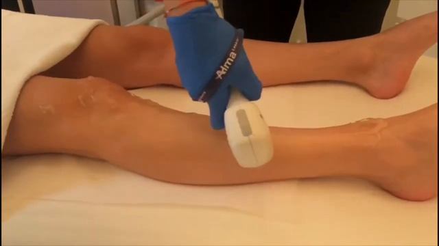 Buz Lazer - Soprano İce PLATİNUM - Vega Estetik смотреть онлайн