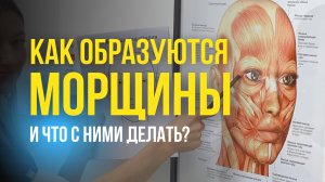 Как образуются морщины? как убрать морщины без ботокса и филлеров?