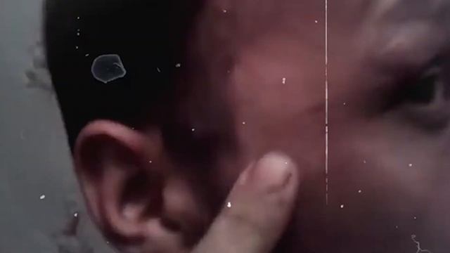 ВИДЕОКАМЕРЫ В ГЛАЗАХ - ТРЕШ ЮТУБА