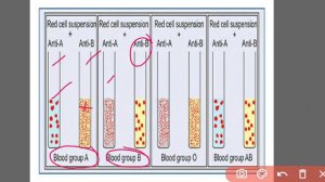 ANTIGEN ANTIBODY REACTIONS AGGLUTINATION PRECIPITATION NEUTRALISATION COMPLEMENT FIXATION ELISA