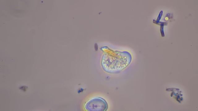 Amoeba limax захват смотреть онлайн