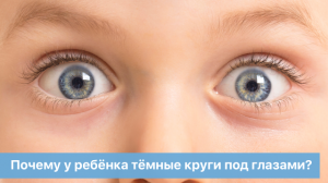 Почему у ребёнка тёмные круги под глазами?