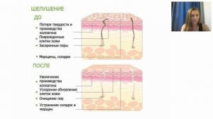 КОСМЕТИЧЕСКИЙ САЛОННЫЙ УХОД ДВУХФАЗОВЫЙ ПИЛИНГ NOVAGE Ксения Нестерова