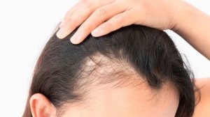 Почему болят корни волос