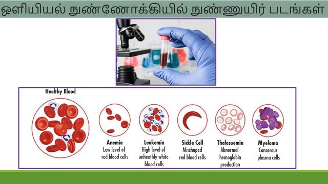 Corona Virus கரோனா நச்சியம் (Part 3) - எலக்ட்ரான் நுண்ணோக்கியாளனின் பார்வை смотреть онлайн