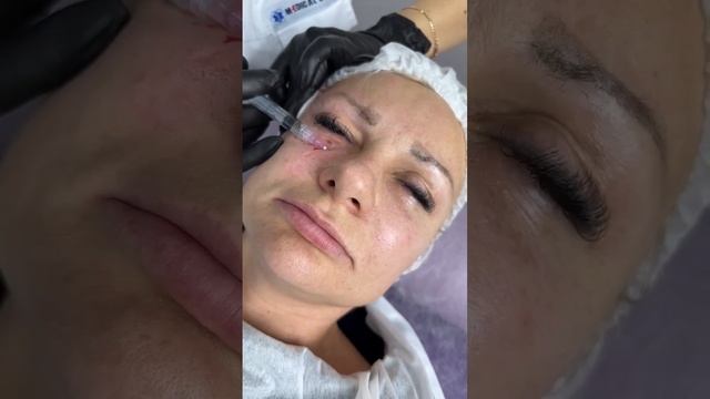 Препарат: AGT M Eye Polyrevitalizing Complex смотреть онлайн