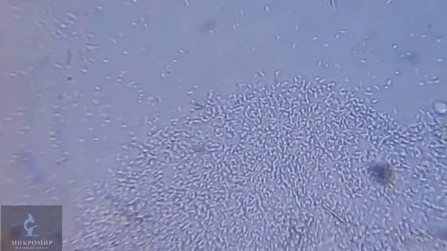 Бактерии цветочной воды под микроскопом смотреть онлайн