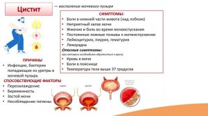 8.3. Мочекаменная болезнь. Цистит. Уретрит