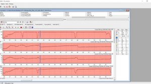Прикрутил турбину к родному мотору Запорожца и замерил разгон
