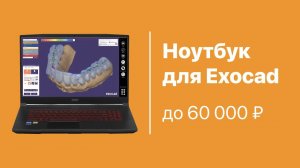 Ноутбук для EXOCAD до 60 000 рублей. На что обратить внимание при выборе ноутбука под Exocad?