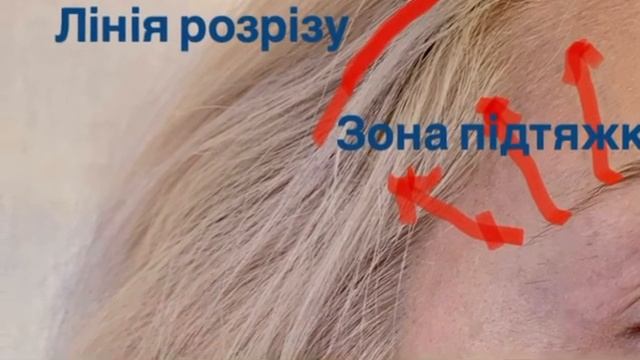 Темпоральний ліфтинг смотреть онлайн