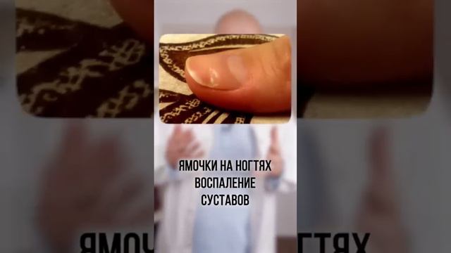 ЭТОТ ВОПРОС ВОЛНУЕТ ВСЕХ⁉️Сибирское здоровье.