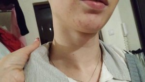 Аутизм. Влад приехал со Дня рождения