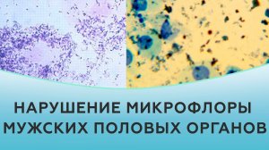 Нарушение микрофлоры мужских половых органов.