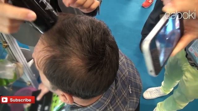 Хотите убрать залысину? Toppik поможет! Реальный отзыв о топпике смотреть онлайн