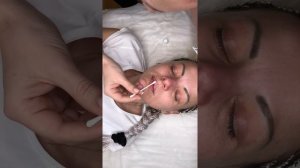 наносим анестезию на эскиз губ