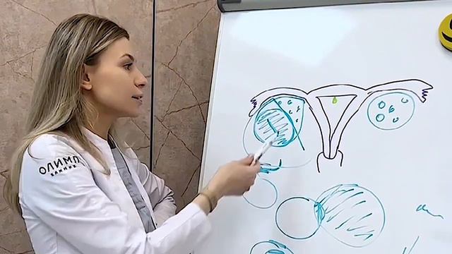 Как удаляются большие кисты, через маленькие проколы.