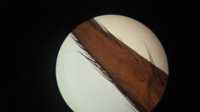 Нога мухи, готовый препарат, увиличение микроскопа 50-160х смотреть онлайн