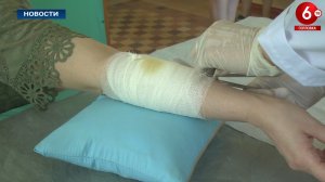 ЧТО ЗА БОЛЕЗНЬ – СТОЛБНЯК?