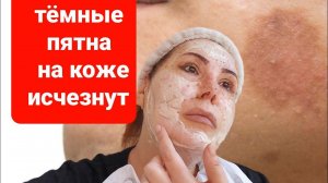 Тёмные пятна на коже быстро исчезнут! Морщины разгладятся! Быстро о очень просто!