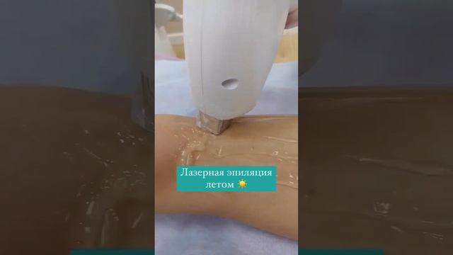 Лазерная эпиляция летом