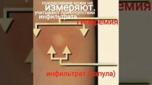 Реакция манту