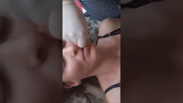 Двусторонняя проработка мимических мышц. Приходите за здоровьем!