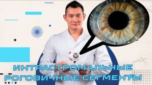 Интрастромальные роговичные сегменты или кольца (ИРС) - Спасение от кератоконуса?