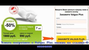 Удаление вальгусной деформации