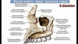 Анатомия верхней челюсти, maxilla, Ахмадудинов А.М.