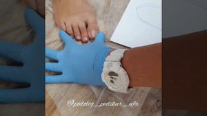 Вросший ноготь. Как правильно подобрать обувь. Советы от подолога Ирина Вагизовна Ахтарьянова