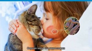 Микроспория гладкой кожи