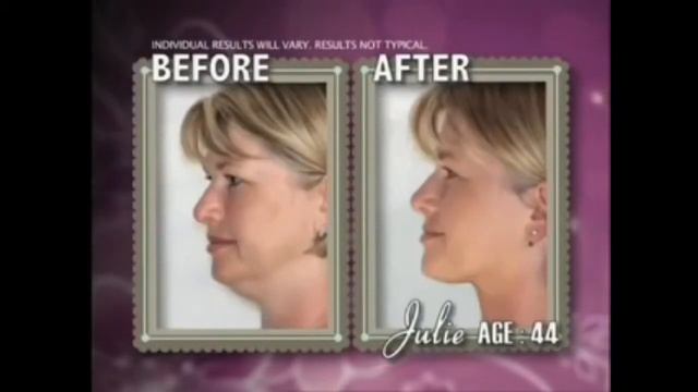 Тренажер для подбородка Cutout Slim смотреть онлайн