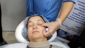 Curacen техника