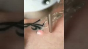 Как сводят татуировки