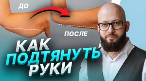 Липосакция рук и плеч (Брахиопластика). Как подтянуть обвисшие руки?