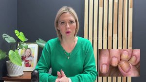 Болезни ногтей и кожи