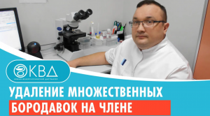 ✅ Удаление множественных бородавок на члене. Клинический случай №863