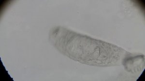 Flatworm (Gyrodactylus sp.)