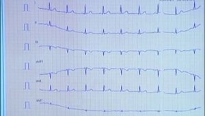 "Подари себе жизнь". Виктор Рыбин. Часть 3.