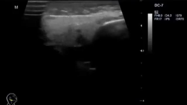 Патология околоушной слюнной железы смотреть онлайн