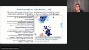 Анализ диагностики патологии железистого эпителия в практике Пап-теста методом жидкостной цитологии