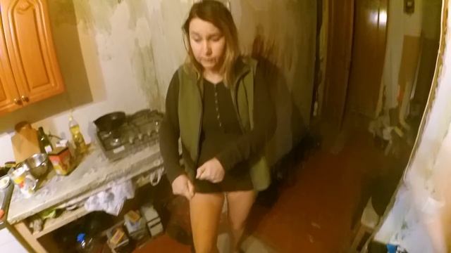 Ожог Обжегся Что Делать при Ожоге ШОК смотреть онлайн