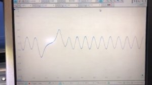 Opel Astra G Z16SE 1.6 dying crankshaft sensor while warming up