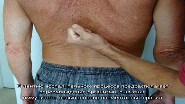 Кровь в моче у мужчин смотреть онлайн