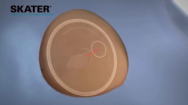 SKATER Drainage Catheter смотреть онлайн