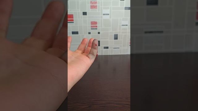 Как избавиться от укуса динозаврового муравья. Последствия укуса смотреть онлайн