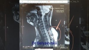 Вдовий горб