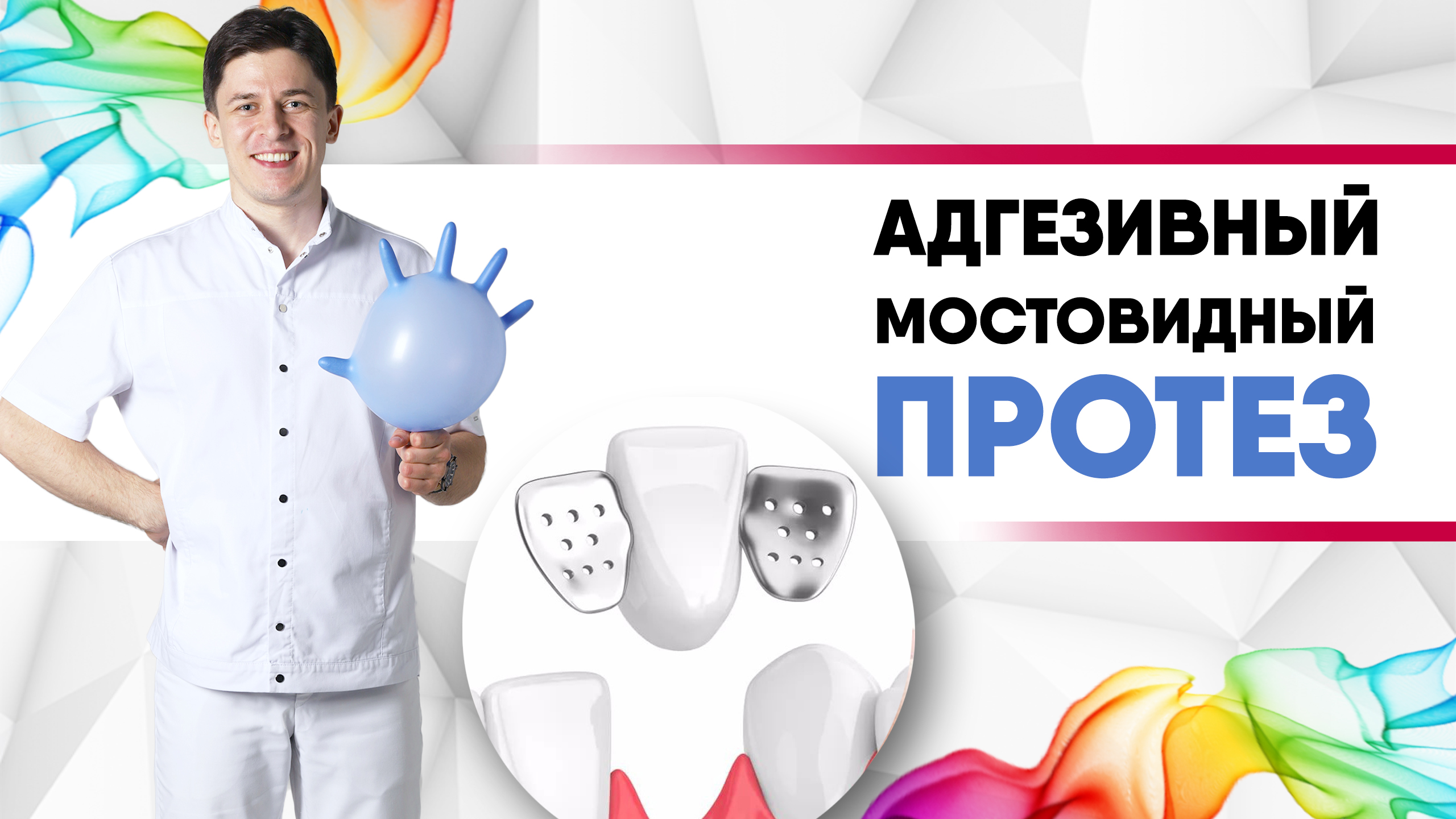Адгезивный мостовидный протез на стекловолоконной ленте [ без обточки и коронок, без имплантов? ].